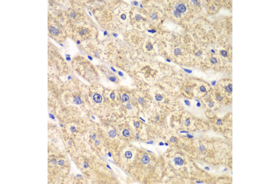 Immunohistochemistry - Anti-ACADS/SCAD Antibody (A16694) - Antibodies.com