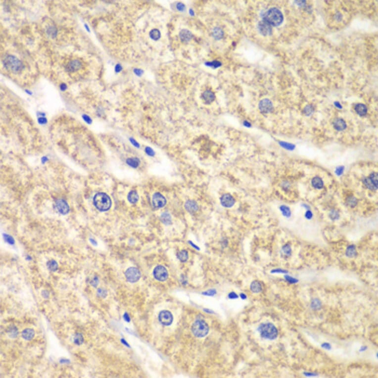 Immunohistochemistry - Anti-ACADS/SCAD Antibody (A16694) - Antibodies.com