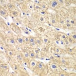 Immunohistochemistry - Anti-ACADS/SCAD Antibody (A16694) - Antibodies.com