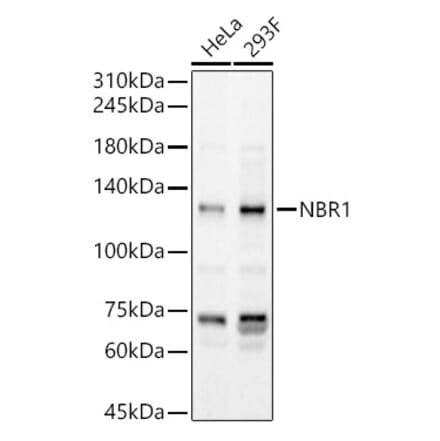 Western Blot - Anti-NBR1 Antibody (A16697) - Antibodies.com