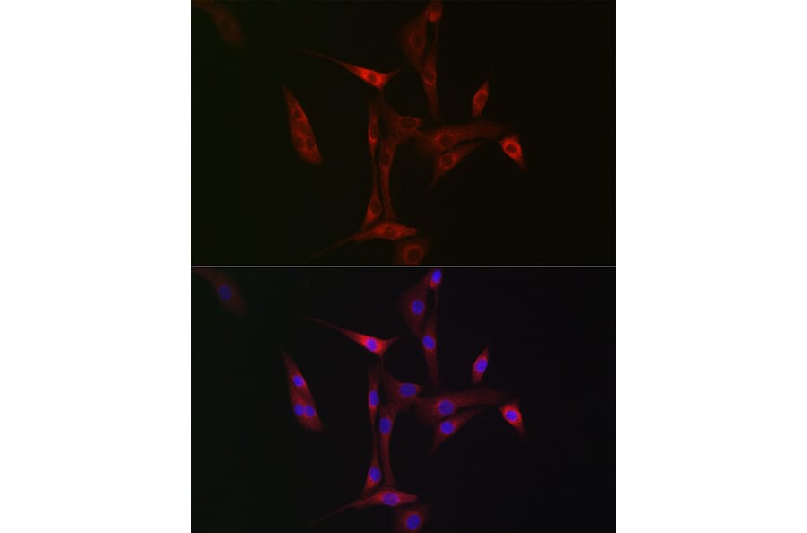 Immunofluorescence - Anti-NBR1 Antibody (A16697) - Antibodies.com