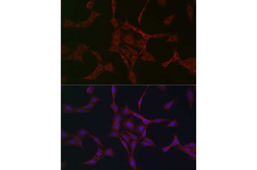 Immunofluorescence - Anti-NBR1 Antibody (A16697) - Antibodies.com