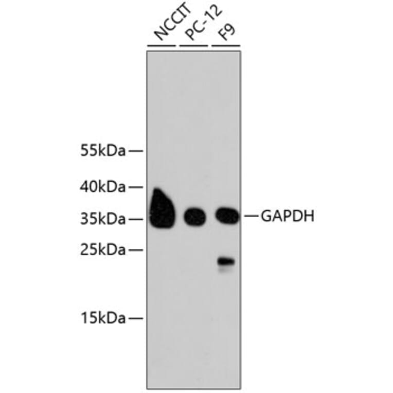Western Blot - Anti-GAPDH Antibody (A10868) - Antibodies.com