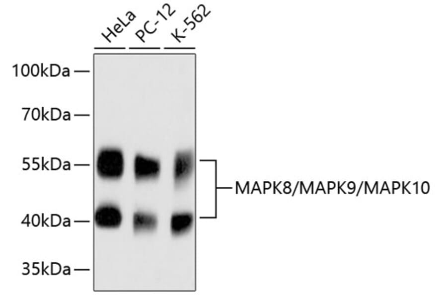 Western Blot - Anti-JNK1 + JNK2 + JNK3 Antibody (A11119) - Antibodies.com