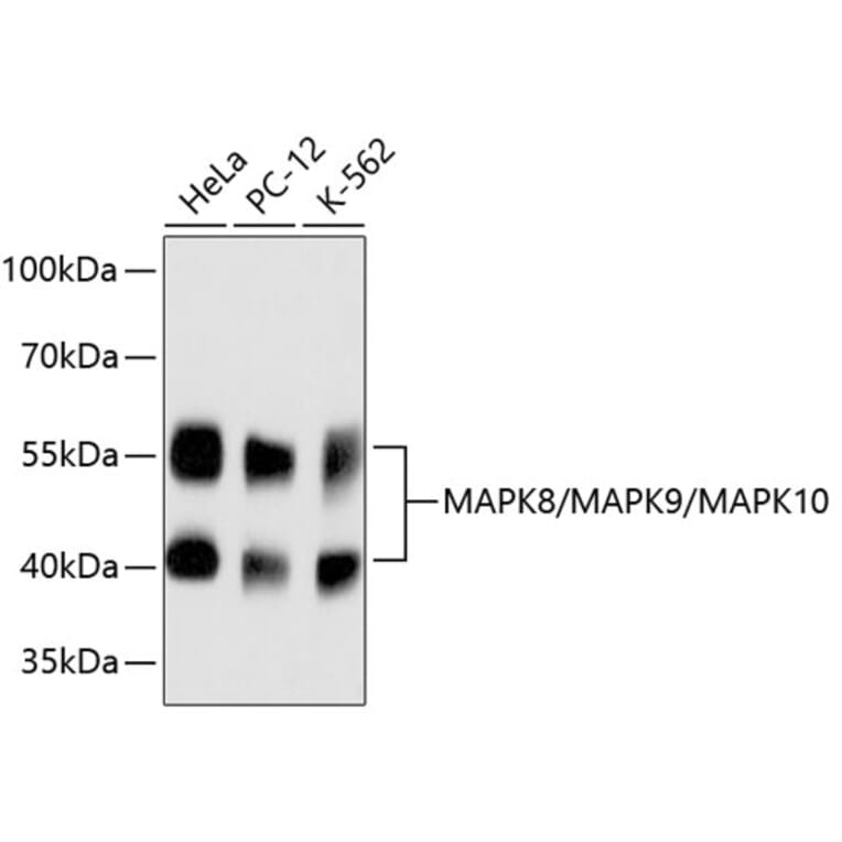 Western Blot - Anti-JNK1 + JNK2 + JNK3 Antibody (A11119) - Antibodies.com