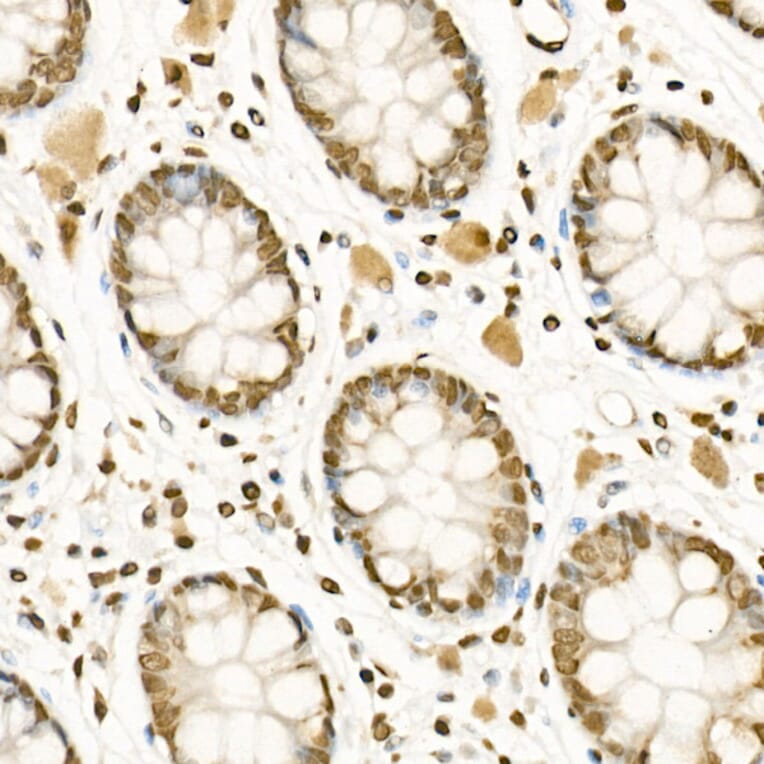 Immunohistochemistry - Anti-Histone H3 (mono methyl Lys4) Antibody (A16703) - Antibodies.com