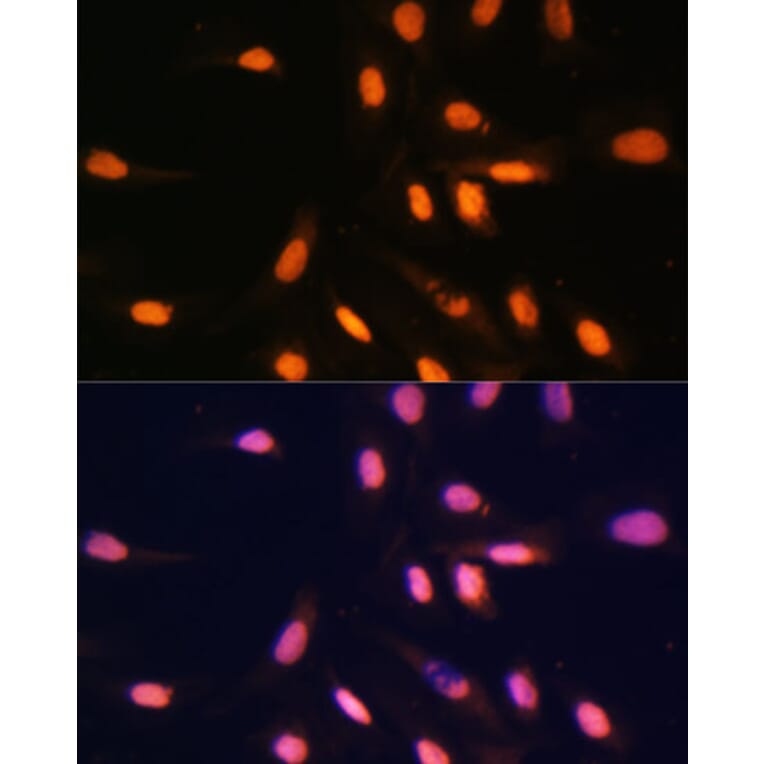 Immunofluorescence - Anti-Histone H3 (mono methyl Lys4) Antibody (A16703) - Antibodies.com