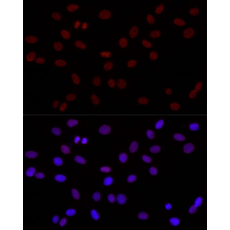 Immunofluorescence - Anti-Histone H3 (di methyl Lys4) Antibody (A16704) - Antibodies.com