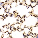 Chromatin Immunoprecipitation - Anti-Histone H3 (di methyl Lys4) Antibody (A16704) - Antibodies.com