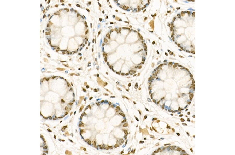 Immunohistochemistry - Anti-Histone H3 (mono methyl Lys9) Antibody (A16706) - Antibodies.com