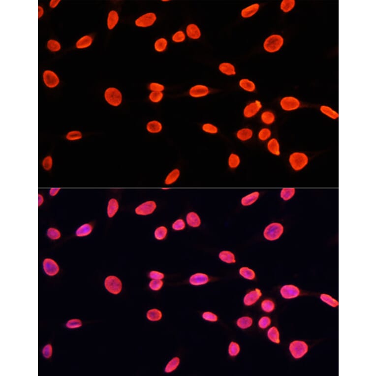 Immunofluorescence - Anti-Histone H3 (mono methyl Lys9) Antibody (A16706) - Antibodies.com