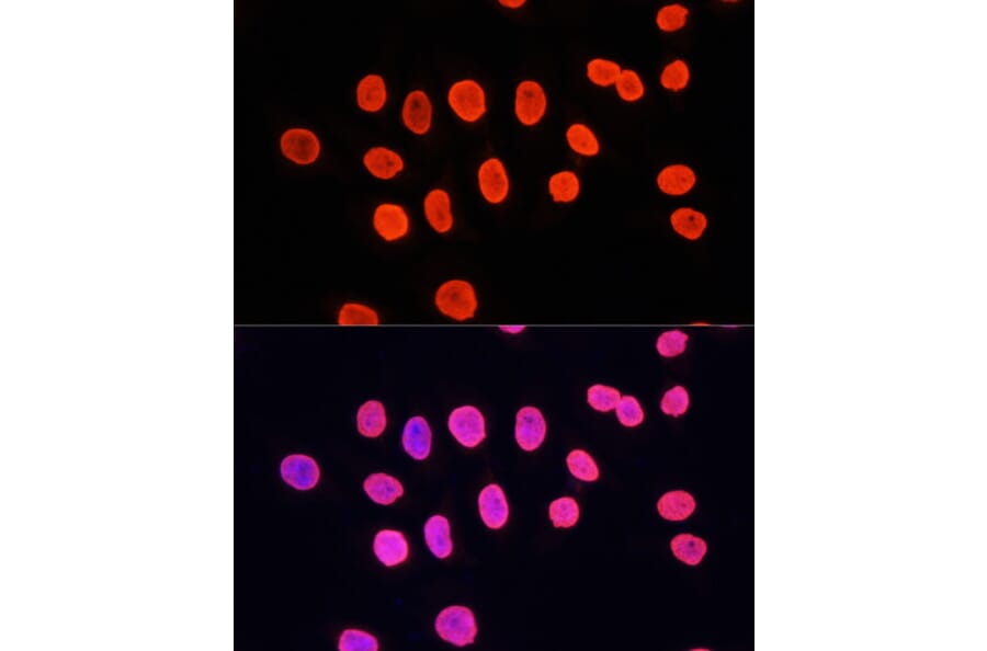 Immunofluorescence - Anti-Histone H3 (mono methyl Lys9) Antibody (A16706) - Antibodies.com