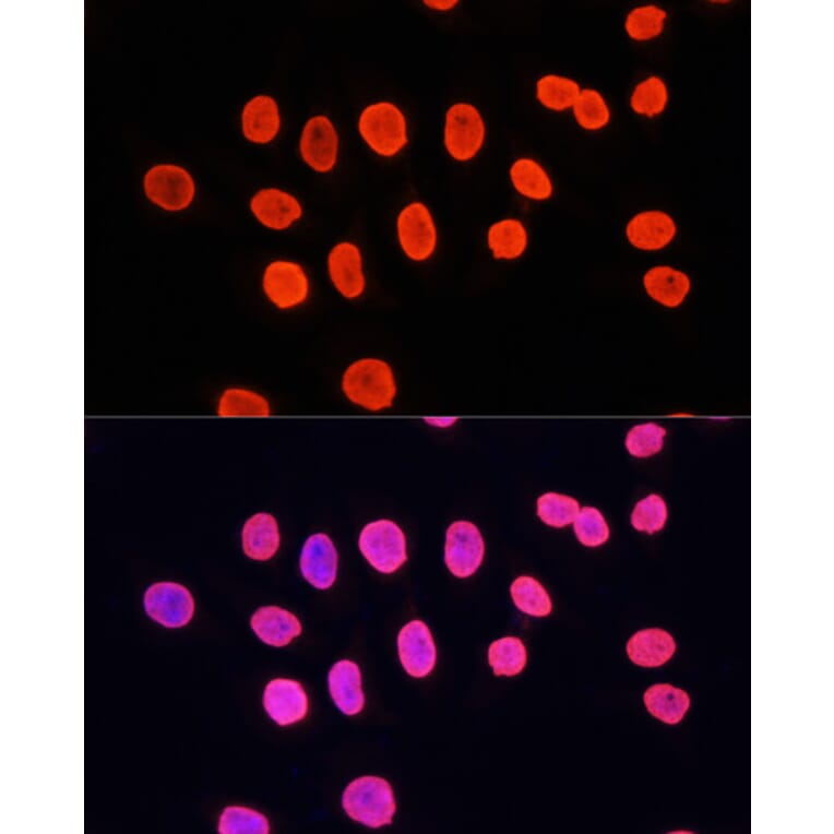 Immunofluorescence - Anti-Histone H3 (mono methyl Lys9) Antibody (A16706) - Antibodies.com