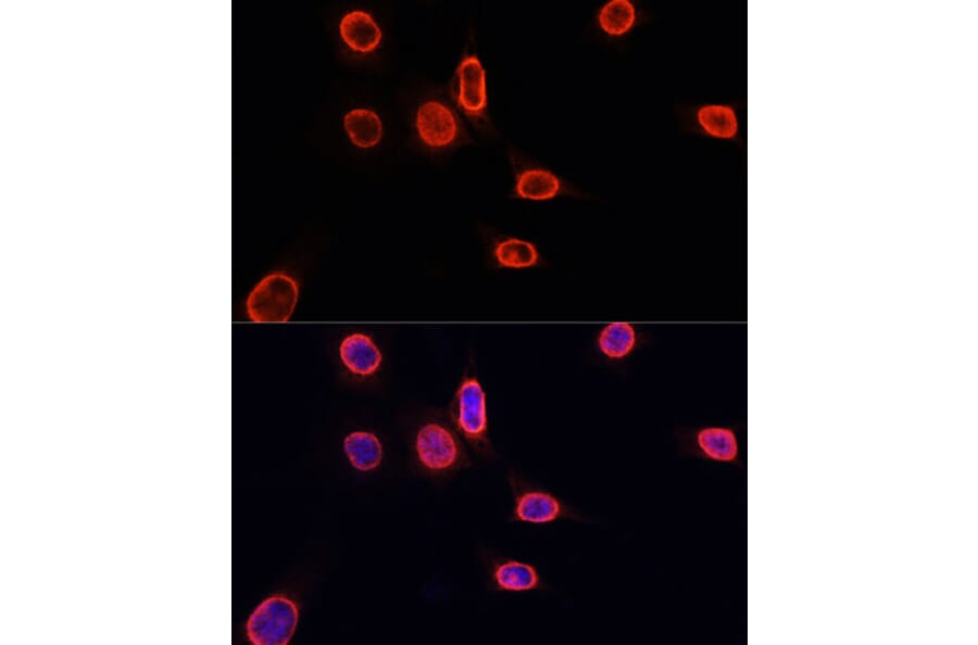Immunofluorescence - Anti-Histone H3 (mono methyl Lys9) Antibody (A16706) - Antibodies.com
