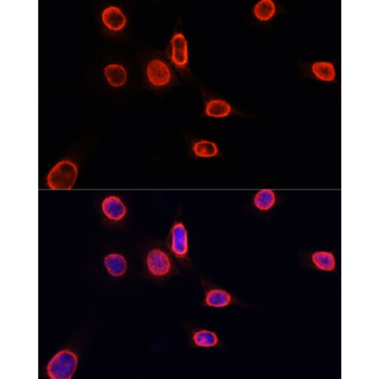 Immunofluorescence - Anti-Histone H3 (mono methyl Lys9) Antibody (A16706) - Antibodies.com