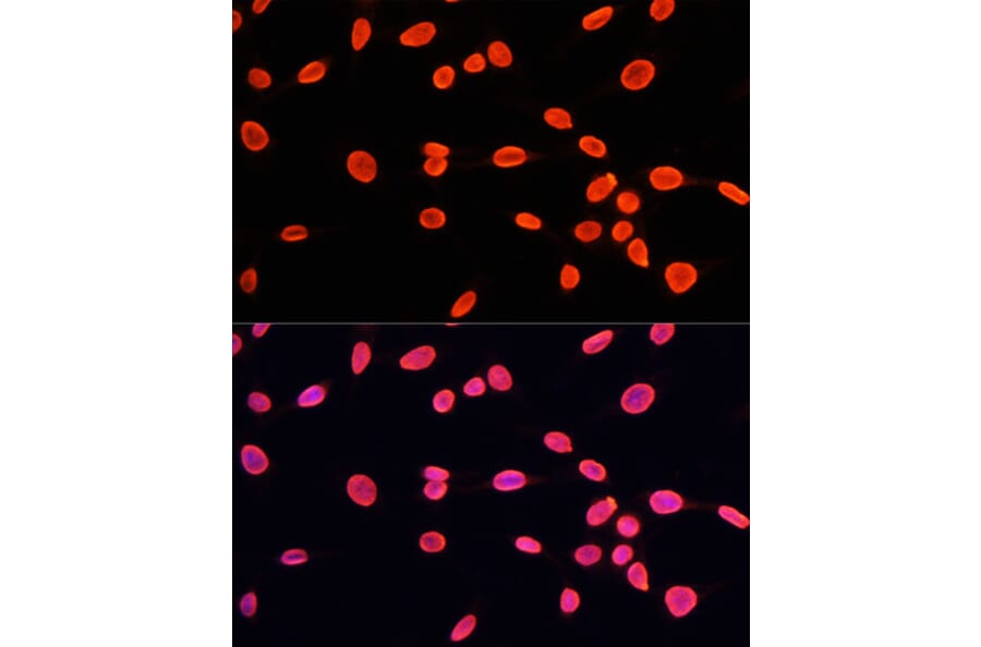Chromatin Immunoprecipitation - Anti-Histone H3 (mono methyl Lys9) Antibody (A16706) - Antibodies.com