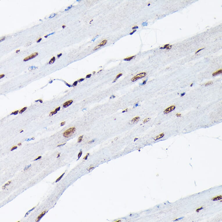 Immunohistochemistry - Anti-Histone H3 (di methyl Lys9) Antibody (A16707) - Antibodies.com