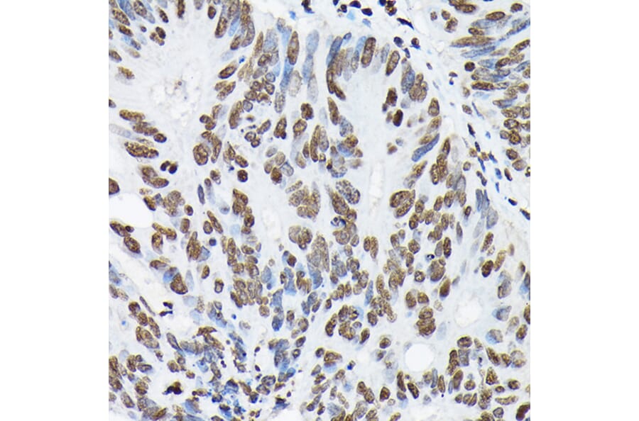 Immunohistochemistry - Anti-Histone H3 (di methyl Lys9) Antibody (A16707) - Antibodies.com