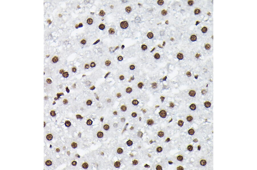 Immunohistochemistry - Anti-Histone H3 (di methyl Lys9) Antibody (A16707) - Antibodies.com
