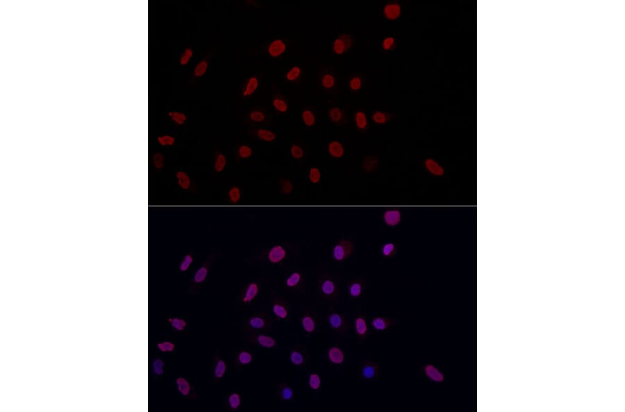 Immunofluorescence - Anti-Histone H3 (di methyl Lys9) Antibody (A16707) - Antibodies.com
