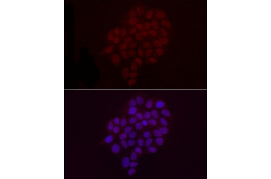 Immunofluorescence - Anti-Histone H3 (di methyl Lys9) Antibody (A16707) - Antibodies.com