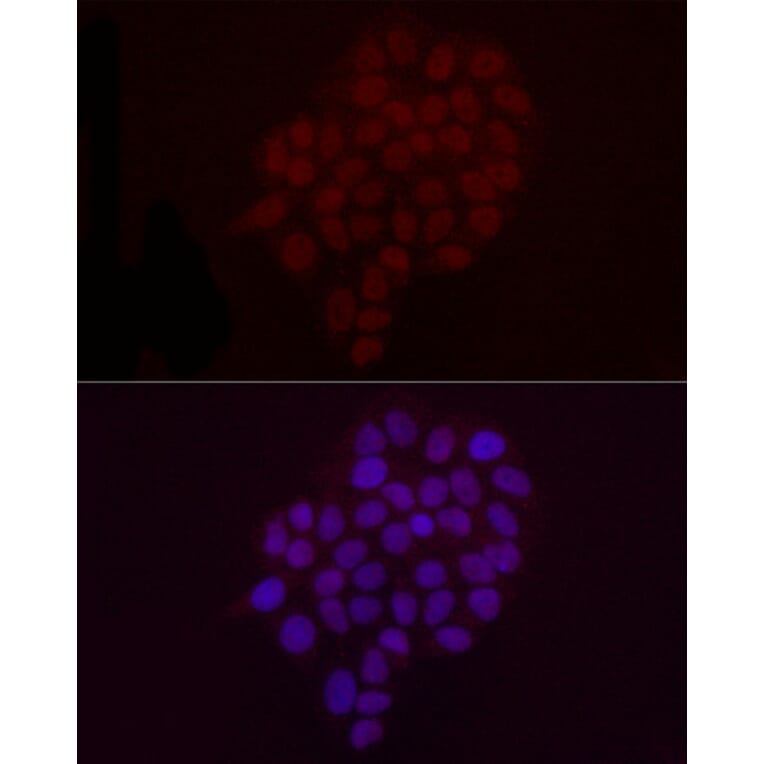 Immunofluorescence - Anti-Histone H3 (di methyl Lys9) Antibody (A16707) - Antibodies.com