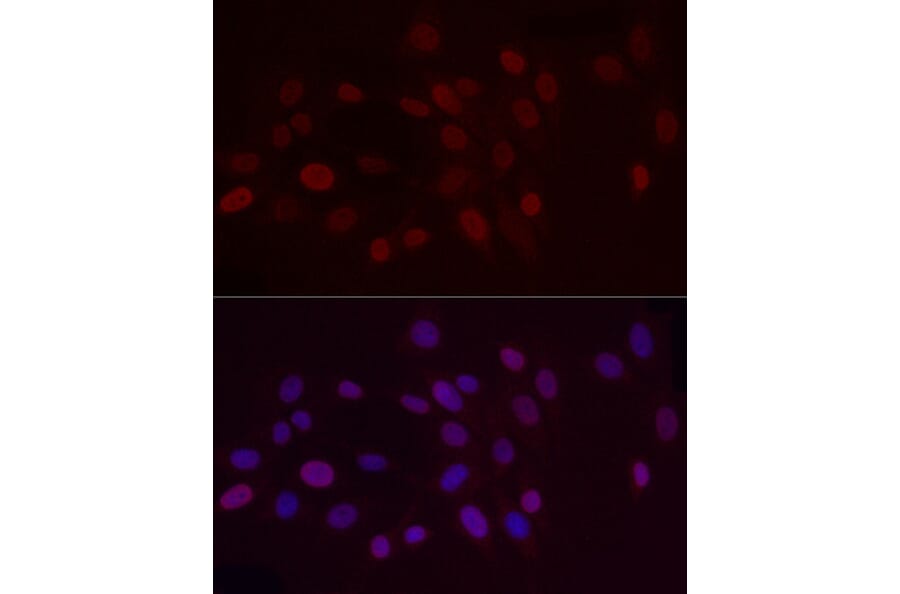 Immunofluorescence - Anti-Histone H3 (di methyl Lys9) Antibody (A16707) - Antibodies.com
