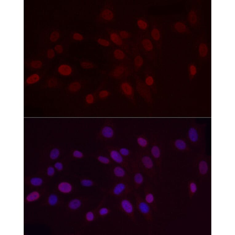 Immunofluorescence - Anti-Histone H3 (di methyl Lys9) Antibody (A16707) - Antibodies.com