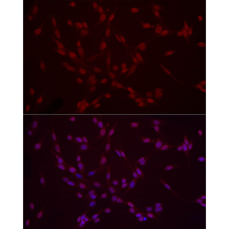 Immunofluorescence - Anti-Histone H3 (di methyl Lys9) Antibody (A16707) - Antibodies.com