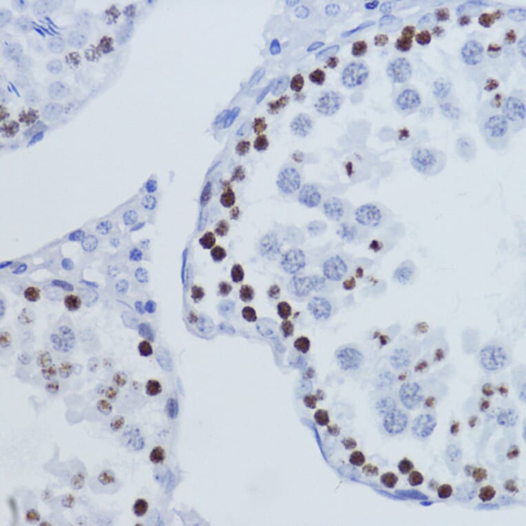 Immunohistochemistry - Anti-Histone H3 (tri methyl Lys9) Antibody (A16708) - Antibodies.com