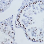 Immunohistochemistry - Anti-Histone H3 (tri methyl Lys9) Antibody (A16708) - Antibodies.com