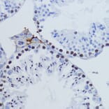 Immunohistochemistry - Anti-Histone H3 (tri methyl Lys9) Antibody (A16708) - Antibodies.com