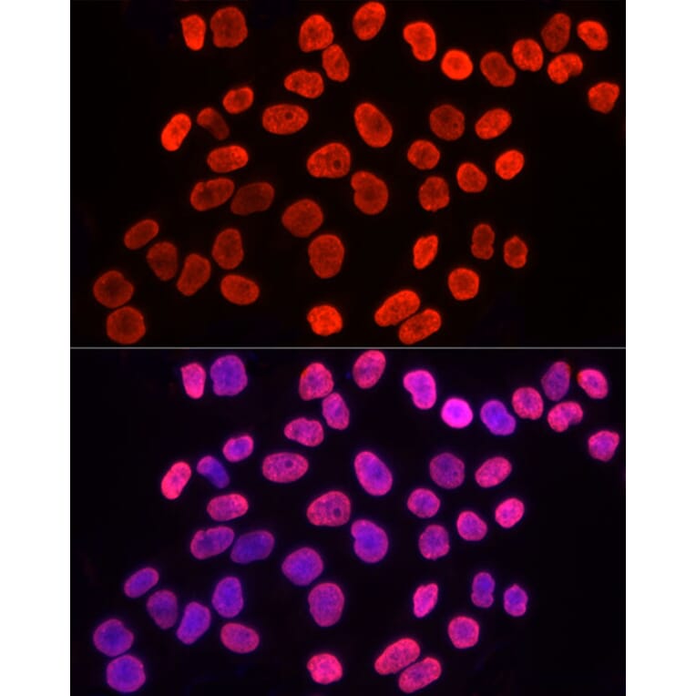 Immunofluorescence - Anti-Histone H3 (tri methyl Lys9) Antibody (A16708) - Antibodies.com