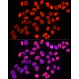 Immunofluorescence - Anti-Histone H3 (tri methyl Lys9) Antibody (A16708) - Antibodies.com
