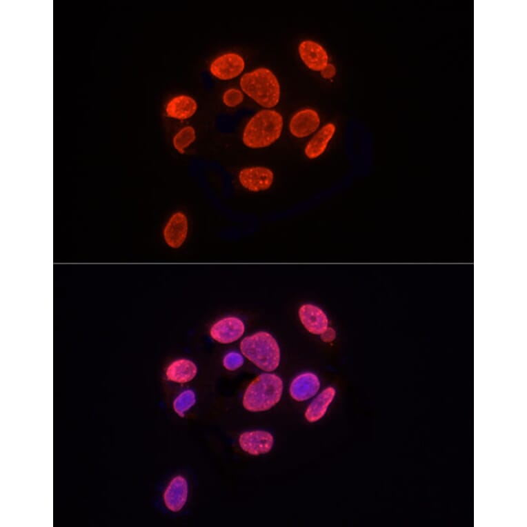 Immunofluorescence - Anti-Histone H3 (tri methyl Lys9) Antibody (A16708) - Antibodies.com