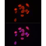 Immunofluorescence - Anti-Histone H3 (tri methyl Lys9) Antibody (A16708) - Antibodies.com