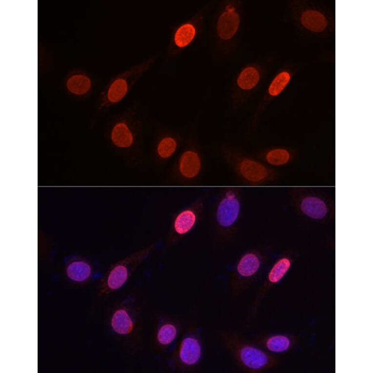 Immunofluorescence - Anti-Histone H3 (tri methyl Lys9) Antibody (A16708) - Antibodies.com