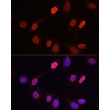 Immunofluorescence - Anti-Histone H3 (tri methyl Lys9) Antibody (A16708) - Antibodies.com
