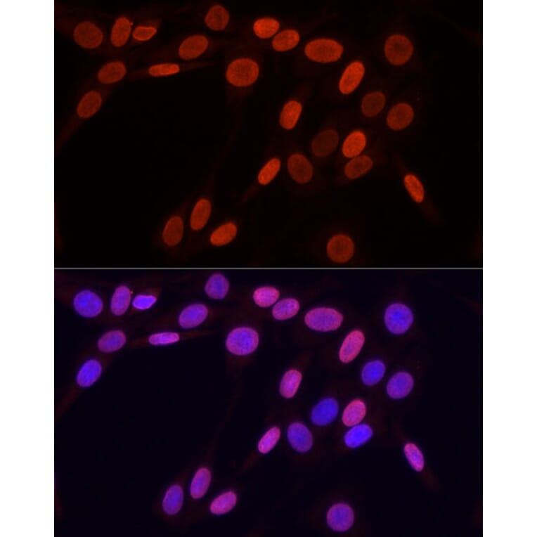 Immunofluorescence - Anti-Histone H3 (tri methyl Lys9) Antibody (A16708) - Antibodies.com