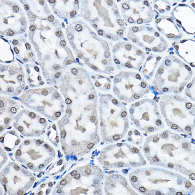 Immunohistochemistry - Anti-Histone H3 (mono methyl Lys27) Antibody (A16709) - Antibodies.com