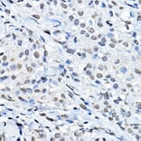 Immunohistochemistry - Anti-Histone H3 (mono methyl Lys27) Antibody (A16709) - Antibodies.com