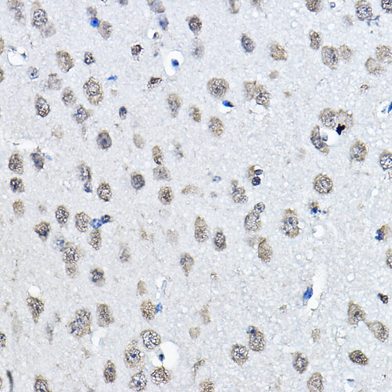 Immunohistochemistry - Anti-Histone H3 (mono methyl Lys27) Antibody (A16709) - Antibodies.com