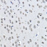 Immunohistochemistry - Anti-Histone H3 (mono methyl Lys27) Antibody (A16709) - Antibodies.com