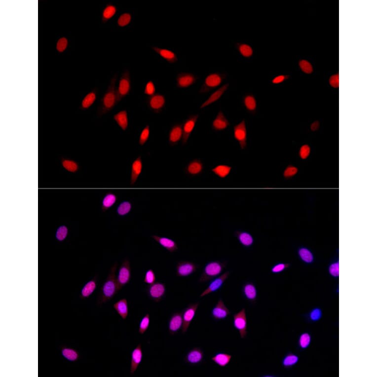 Immunofluorescence - Anti-Histone H3 (mono methyl Lys27) Antibody (A16709) - Antibodies.com