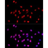 Immunofluorescence - Anti-Histone H3 (mono methyl Lys27) Antibody (A16709) - Antibodies.com
