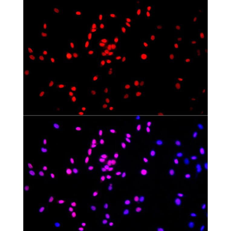 Immunofluorescence - Anti-Histone H3 (mono methyl Lys27) Antibody (A16709) - Antibodies.com