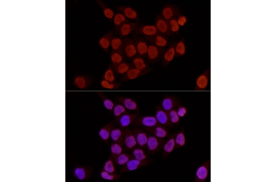 Immunofluorescence - Anti-Histone H3 (di methyl Lys27) Antibody (A16710) - Antibodies.com