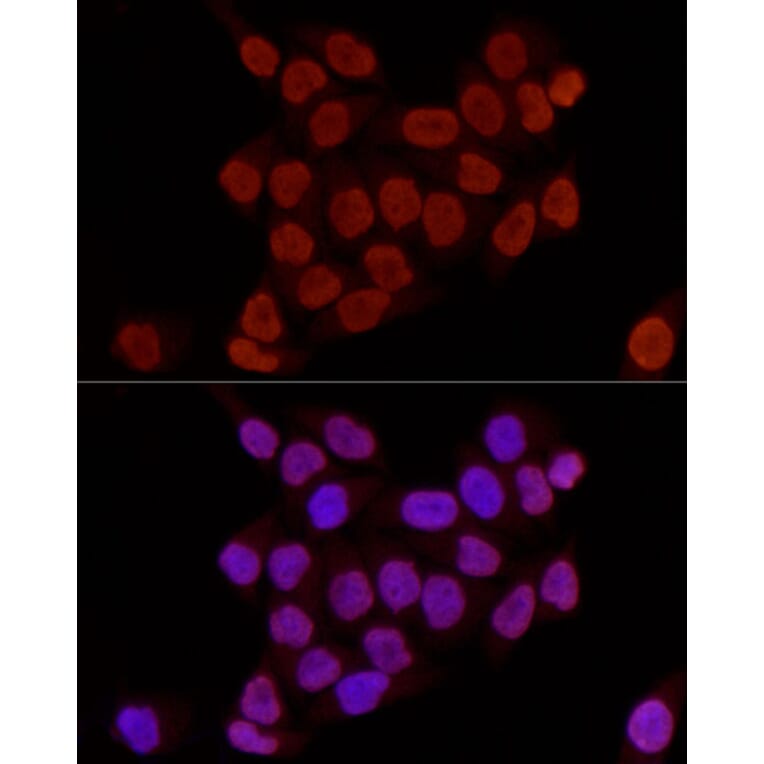 Immunofluorescence - Anti-Histone H3 (di methyl Lys27) Antibody (A16710) - Antibodies.com