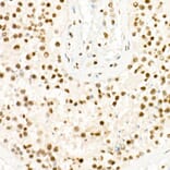 Immunohistochemistry - Anti-Histone H3 (tri methyl Lys27) Antibody (A16711) - Antibodies.com