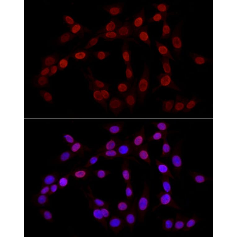 Immunofluorescence - Anti-Histone H3 (tri methyl Lys27) Antibody (A16711) - Antibodies.com